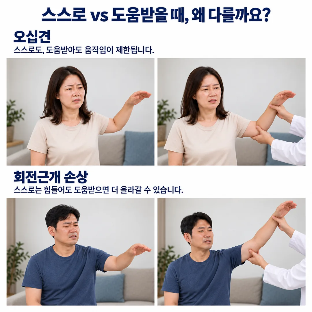 오십견은 스스로 올릴 때도 도움받아 올릴 때도 움직임이 제한되고, 회전근개 손상은 스스로는 힘들어도 도움을 받으면 더 올라갈 수 있다는 차이를 네 장면으로 비교한 카드