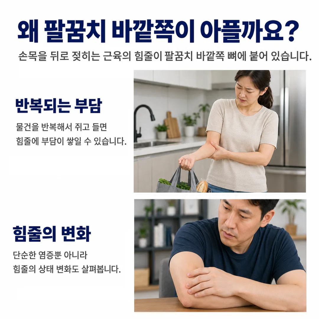 장바구니를 들며 팔꿈치 바깥쪽 통증을 느끼는 여성과 팔꿈치를 짚고 앉은 남성의 모습으로, 손목을 반복해서 쥐고 드는 동작이 힘줄에 부담을 쌓이게 하고 단순 염증을 넘어선 힘줄 상태 변화도 함께 살펴본다는 내용을 정리한 카드