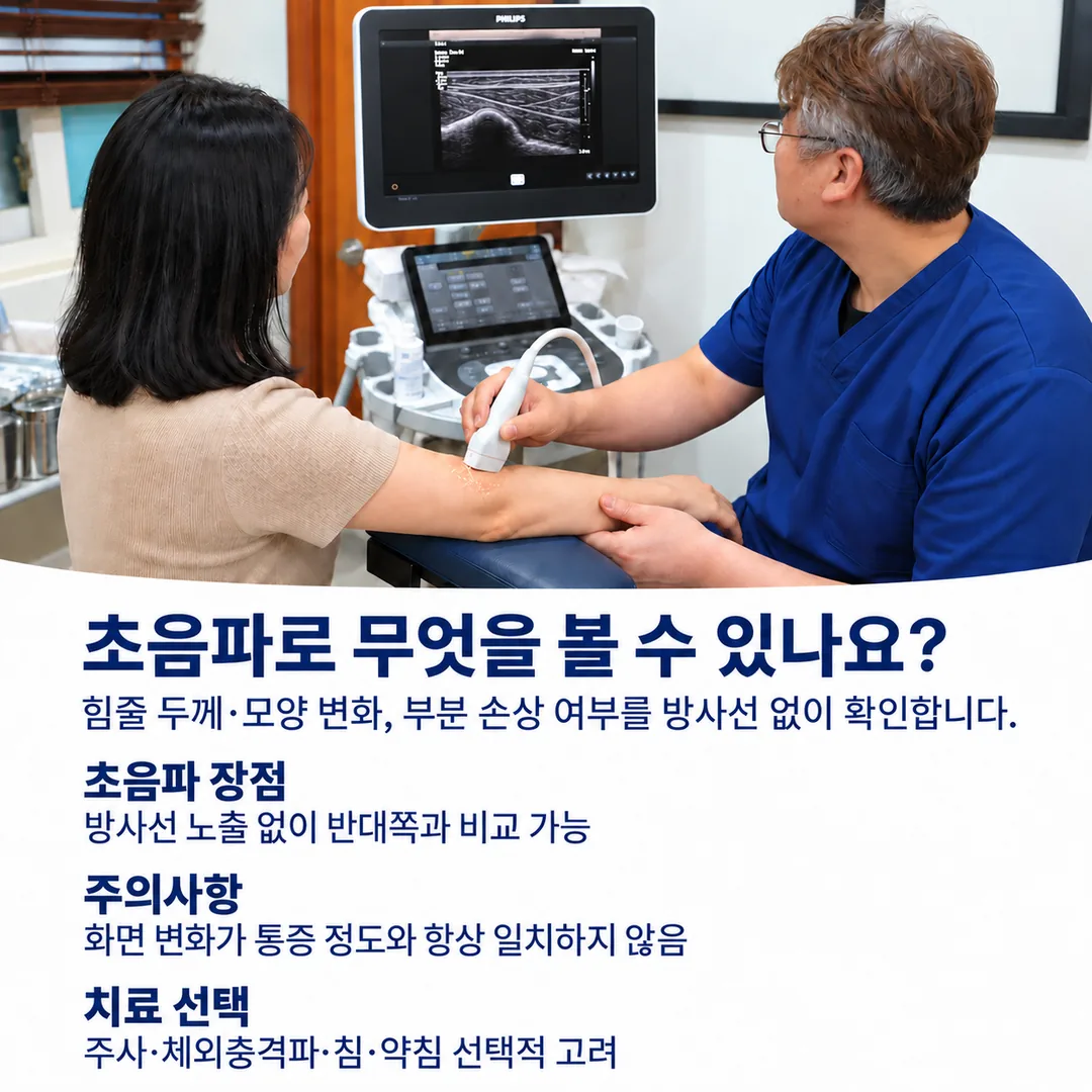 초음파로 팔꿈치 바깥쪽 힘줄을 관찰하는 진료 장면과, 방사선 없이 힘줄 두께·모양 변화를 확인하되 화면 변화가 통증 정도와 항상 일치하지는 않는다는 안내, 주사·체외충격파·침·약침을 선택적으로 고려한다는 내용을 정리한 카드