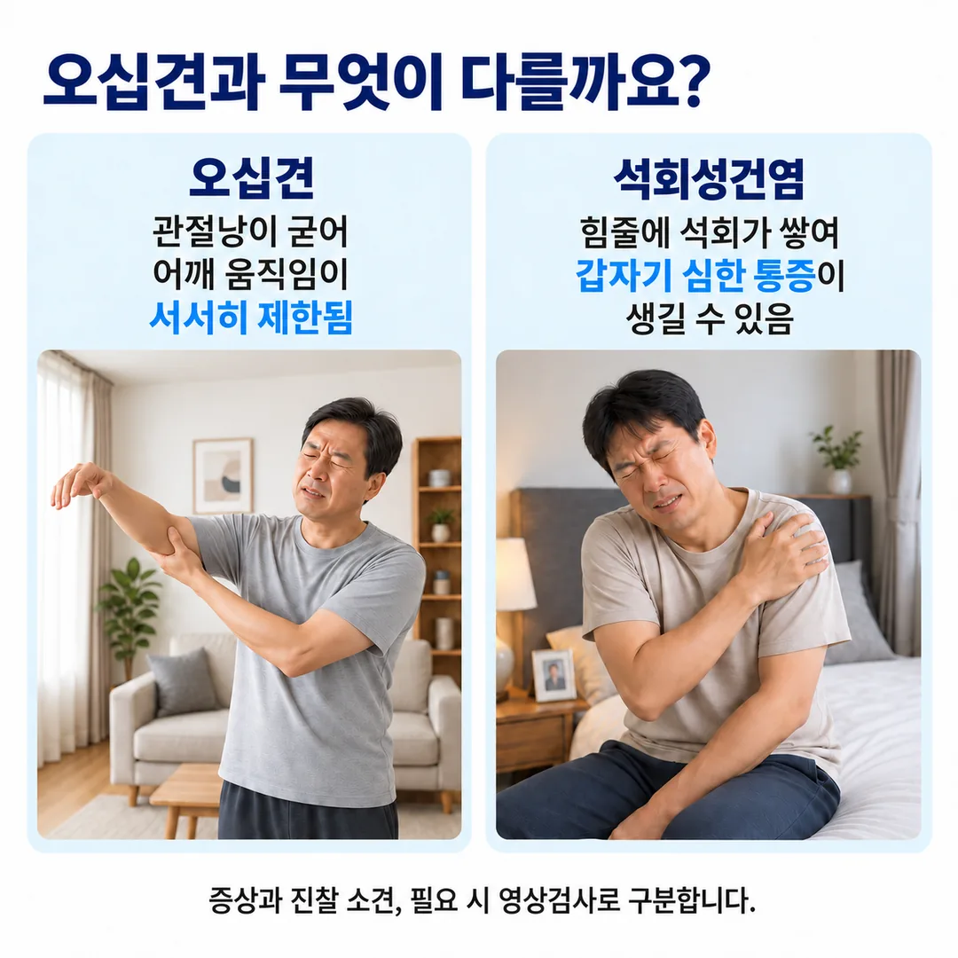 관절낭이 굳어 움직임이 서서히 제한되는 오십견과, 힘줄에 석회가 쌓여 갑자기 심한 통증이 생기는 석회성건염을 나란히 비교한 카드