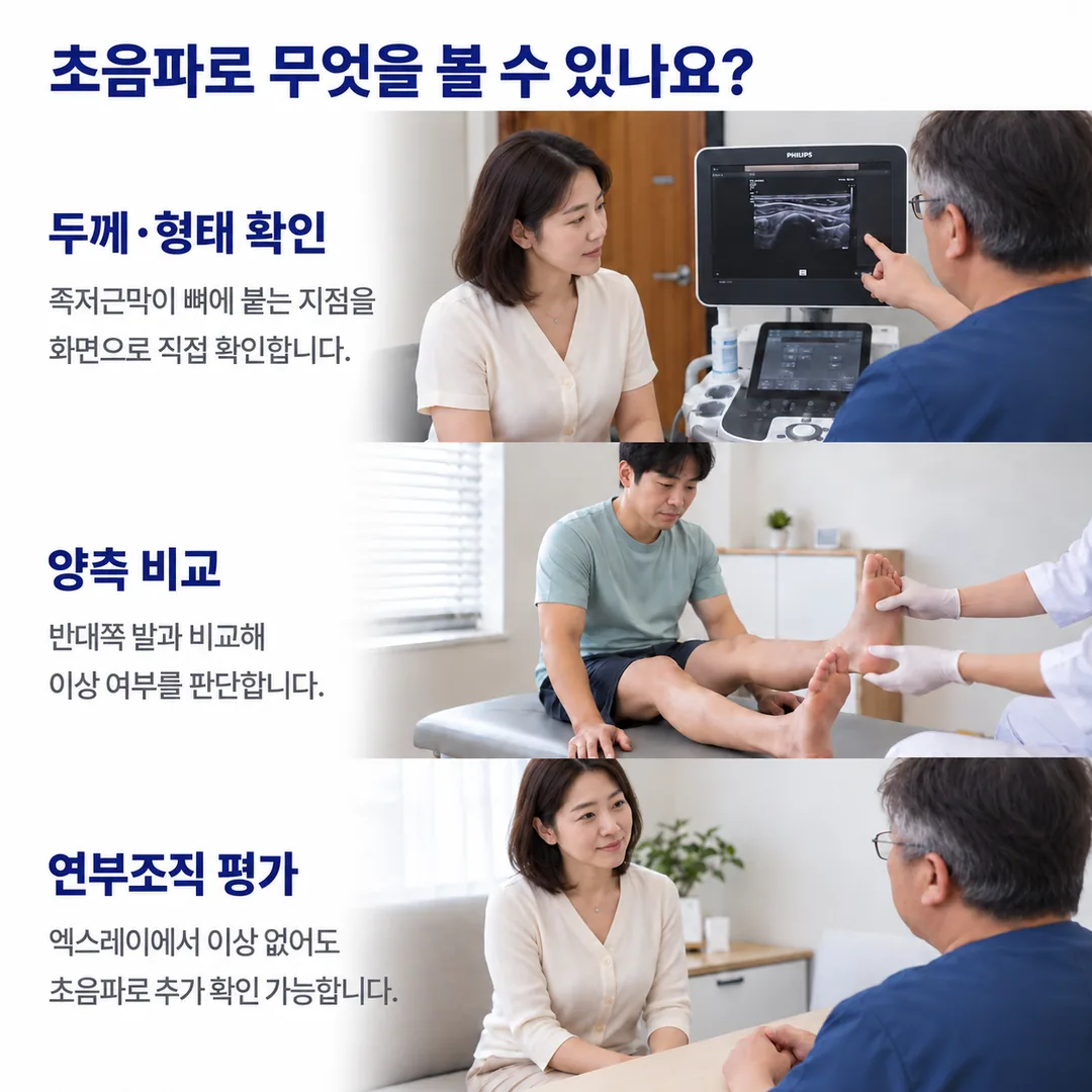 진료실에서 초음파 화면으로 족저근막이 뼈에 붙는 자리의 두께와 형태를 확인하고, 반대쪽 발과 비교하며, 엑스레이에서 이상이 없어도 연부 조직을 초음파로 추가 확인할 수 있다는 안내 카드