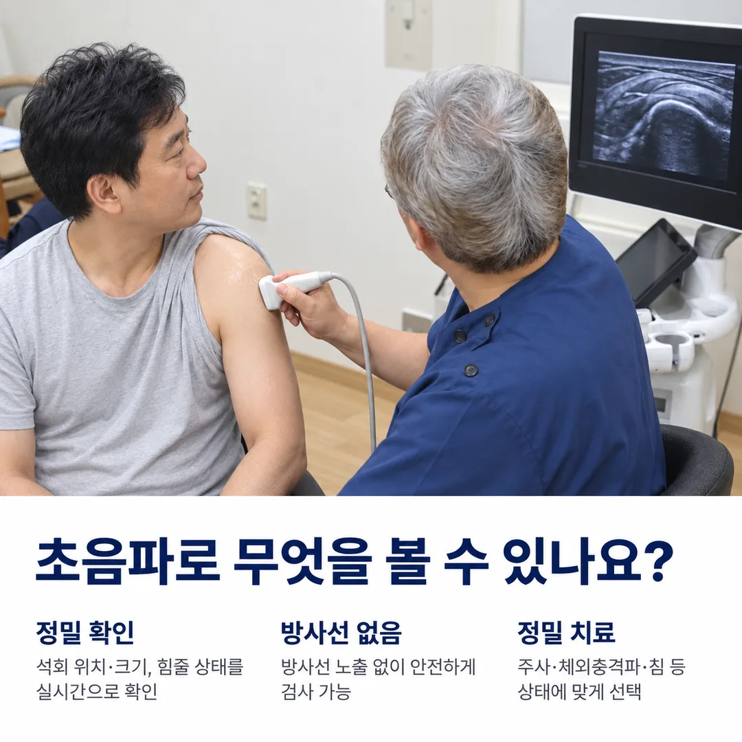 초음파 탐촉자로 어깨를 확인하는 모습과 화면에 나타난 힘줄 단면 영상을 보여 주며, 석회의 위치·크기와 힘줄 상태를 방사선 노출 없이 확인할 수 있다는 안내 카드